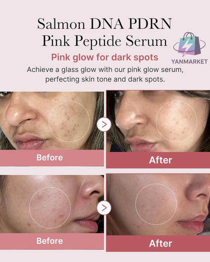 SERUM COREANO DE SALMON MEDICUBE PDRN